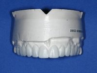 upper teeth model