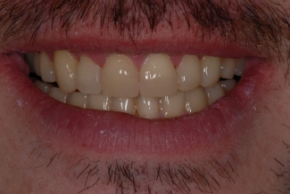 9-after