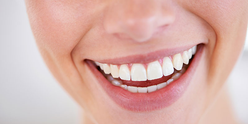 Smile design with Cosmetic dentistry & tooth whitening