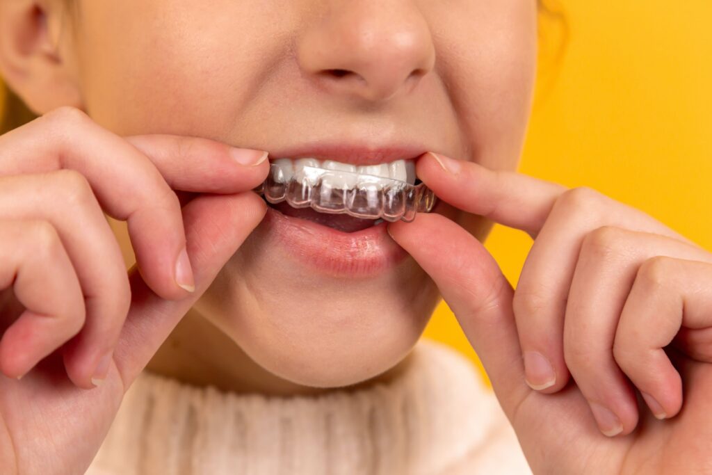 Orthodontics aligners Parkstone Dental Practice Poole